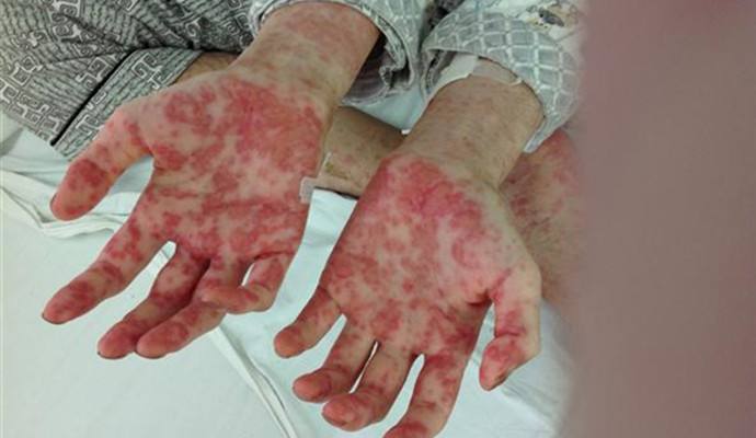 室內甲醛檢測治理，你不得不需要了解的三點！